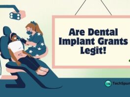are dental implant grants legit